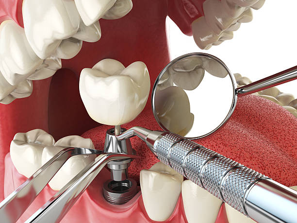 Best Urgent Care for Lost Fillings or Crowns in De Queen, AR